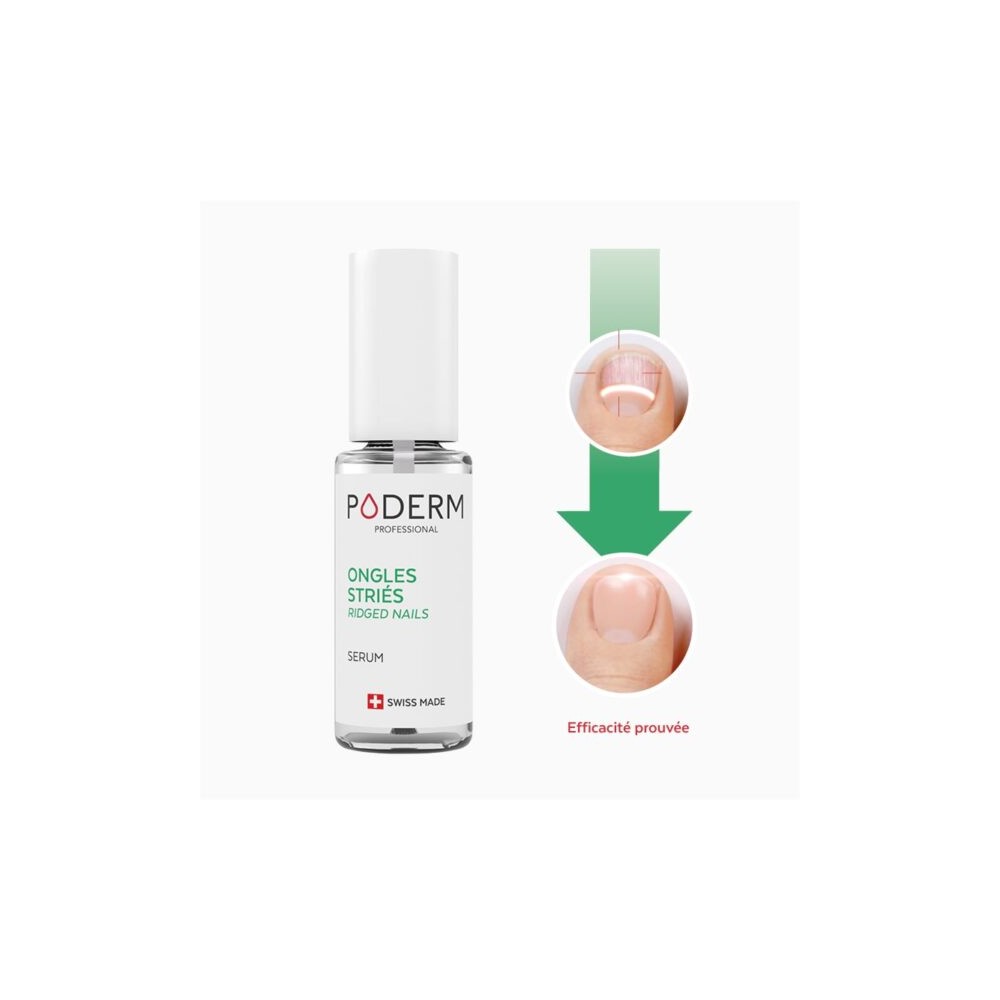 Serum Nourissant ongles striés et cassants - Poderm